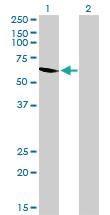 Anti-UGP2 Mouse Monoclonal Antibody [clone: 3H3]