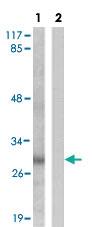 Anti-PRKAB1 Rabbit Polyclonal Antibody