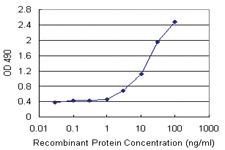 Anti-STIP1 Polyclonal Antibody Pair