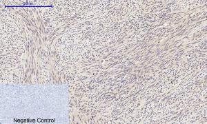 Immunohistochemical analysis of paraffin-embedded human uterus tissue using Anti-eIF2 alpha Antibody at 1:200 (4°C overnight). Negative control was secondary antibody only