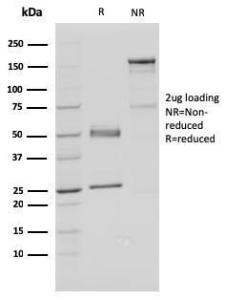 SDS-PAGE analysis of Anti-FAF1 Antibody [CPTC-FAF1-2] under non-reduced and reduced conditions; showing intact IgG and intact heavy and light chains, respectively. SDS-PAGE analysis confirms the integrity and purity of the Antibody