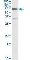 Anti-CBS Antibody Pair