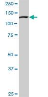 Anti-NLRP2 Rabbit Polyclonal Antibody