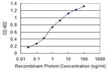 Anti-PIP4K2C Mouse Monoclonal Antibody [clone: 3E10]