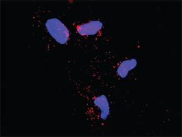 Anti-ECSIT Mouse Monoclonal Antibody [clone: 1B8]