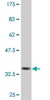 Anti-CTHRC1 Mouse Monoclonal Antibody [clone: 1G12]