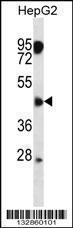 Anti-CLMP Rabbit Polyclonal Antibody (AP (Alkaline Phosphatase))