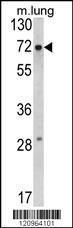 Anti-FMR1 Rabbit Polyclonal Antibody (APC (Allophycocyanin))