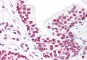 Anti-MAX Antibody (A82896) (10 µg/ml) staining of paraffin embedded Human Prostate. Steamed antigen retrieval with citrate buffer pH 6, AP-staining