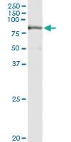 Anti-PRMT7 Polyclonal Antibody Pair