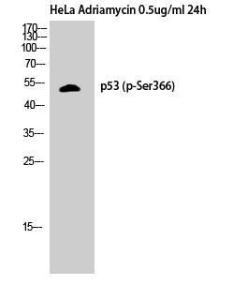 Anti-p53 Rabbit Polyclonal Antibody