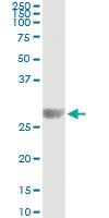 Anti-KIRREL2 Antibody Pair