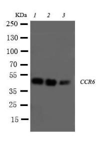 Anti-CCR6 Rabbit Polyclonal Antibody