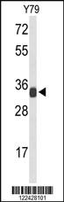 Anti-RPL5 Rabbit Polyclonal Antibody