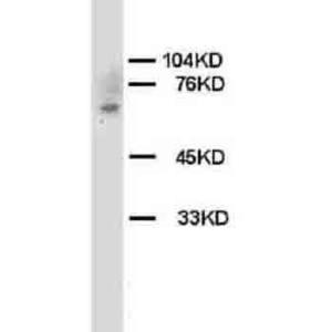 Anti-Chk2 Rabbit Polyclonal Antibody