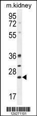 Anti-BCL10 Rabbit Polyclonal Antibody (AP (Alkaline Phosphatase))