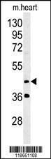 Anti-MYLIP Rabbit Polyclonal Antibody (HRP (Horseradish Peroxidase))