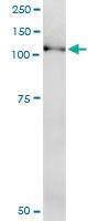 Anti-NLRP2 Rabbit Polyclonal Antibody