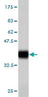 Anti-ADAM2 Mouse Monoclonal Antibody [clone: 4A2]