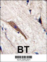 Anti-PAK6 Rabbit Polyclonal Antibody (Biotin)