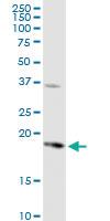 Anti-PTGES Rabbit Polyclonal Antibody