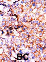 Anti-HIST3H3 Rabbit Polyclonal Antibody (APC (Allophycocyanin))