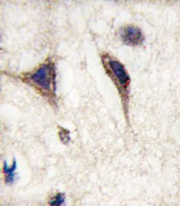 Anti-MAPT Rabbit Polyclonal Antibody (Biotin)