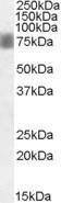 Antibody anti-NUAK1 100 µg