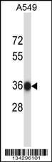 Anti-NAPB Rabbit Polyclonal Antibody