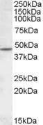 Anti-CHRNB2 Antibody (A84499) (1µg/ml) staining of Human Cerebellum lysate (35µg protein in RIPA buffer). Detected by chemiluminescence.