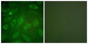 Immunofluorescence analysis of NIH/3T3 cells using Anti-Collagen I Antibody. The right hand panel represents a negative control, where the antibody was pre-incubated with the immunising peptide.