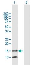 Anti-PTGES Rabbit Polyclonal Antibody