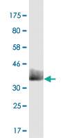 Anti-TBL1XR1 Mouse Monoclonal Antibody [clone: 3G7]