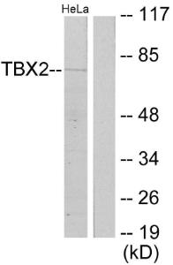 Western blot analysis of lysates from HeLa cells using Anti-TBX2 Antibody. The right hand lane represents a negative control, where the antibody is blocked by the immunising peptide.