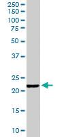 Anti-GPX2 Goat Polyclonal Antibody