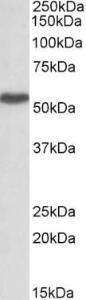 Anti-LSP1 Antibody (A82897) (1 µg/ml) staining of Peripheral Blood Lymphocytes lysate (35 µg protein in RIPA buffer) Primary incubation was 1 hour Detected by chemiluminescence