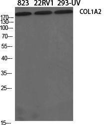 Western blot analysis of various cells using Anti-Collagen I Antibody