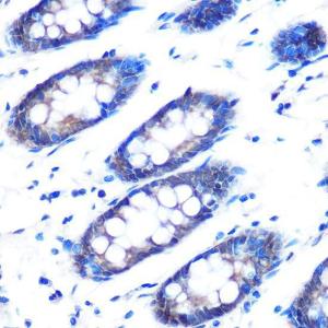 Immunohistochemistry analysis of paraffin-embedded human colon tissue using Anti-hHR23b Antibody (A306047) at a dilution of 1:100 (40x lens) Perform microwave antigen retrieval with 10 mM PBS buffer pH 72 before commencing with IHC staining protocol