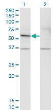 Anti-DFNA5 Mouse Monoclonal Antibody [clone: 1E10]