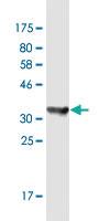 Anti-STIP1 Mouse Monoclonal Antibody [clone: 1B10]