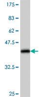 Anti-UBTF Mouse Polyclonal Antibody