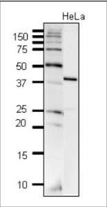 Anti-DNA Polymerase beta Antibody