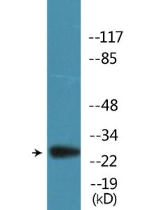 Western blot analysis of lysates from 293, Jurkat and NIH/3T3 cells treated with Piclitaxel using Anti-BCL2 (phospho Ser70) Antibody