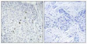 Antibody anti-ZNF785 100 µg