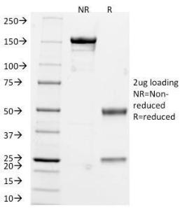 SDS-PAGE analysis of Anti-Chromogranin A Antibody [CHGA/765] under non-reduced and reduced conditions; showing intact IgG and intact heavy and light chains, respectively. SDS-PAGE analysis confirms the integrity and purity of the antibody