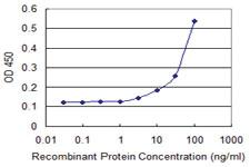 Anti-DFNA5 Mouse Monoclonal Antibody [clone: 1E10]