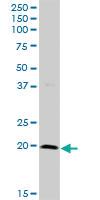 Anti-PTGES Rabbit Polyclonal Antibody