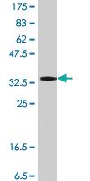 Anti-DCP1A Mouse Polyclonal Antibody