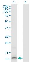 Anti-SLURP1 Mouse Monoclonal Antibody [clone: 4D1]