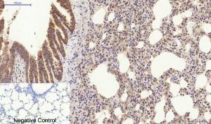 Immunohistochemical analysis of paraffin-embedded rat lung tissue using Anti-Collagen I Antibody at 1:200 (4°C overnight). Negative control was secondary antibody only.